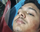 Mangaluru: Teenager stabbed, injured at Bajpe